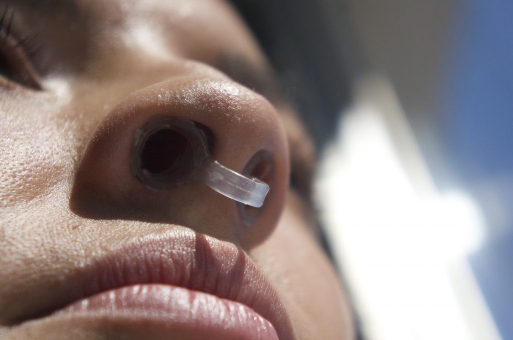 dilatador-nasal-2